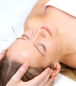 Acupuncture FAQ